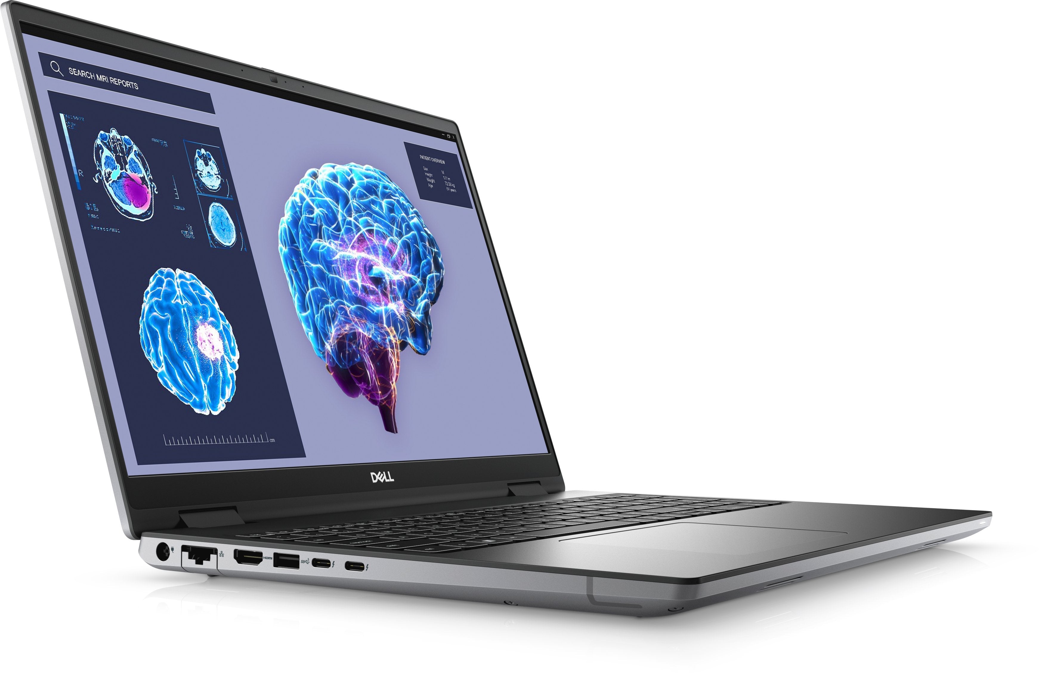 Portátil Dell Workstation Precision 7680 I7-13850hx 32gb 1tb 16" Fhd+ Nvidia Rtx 3500 Smtcd W11p