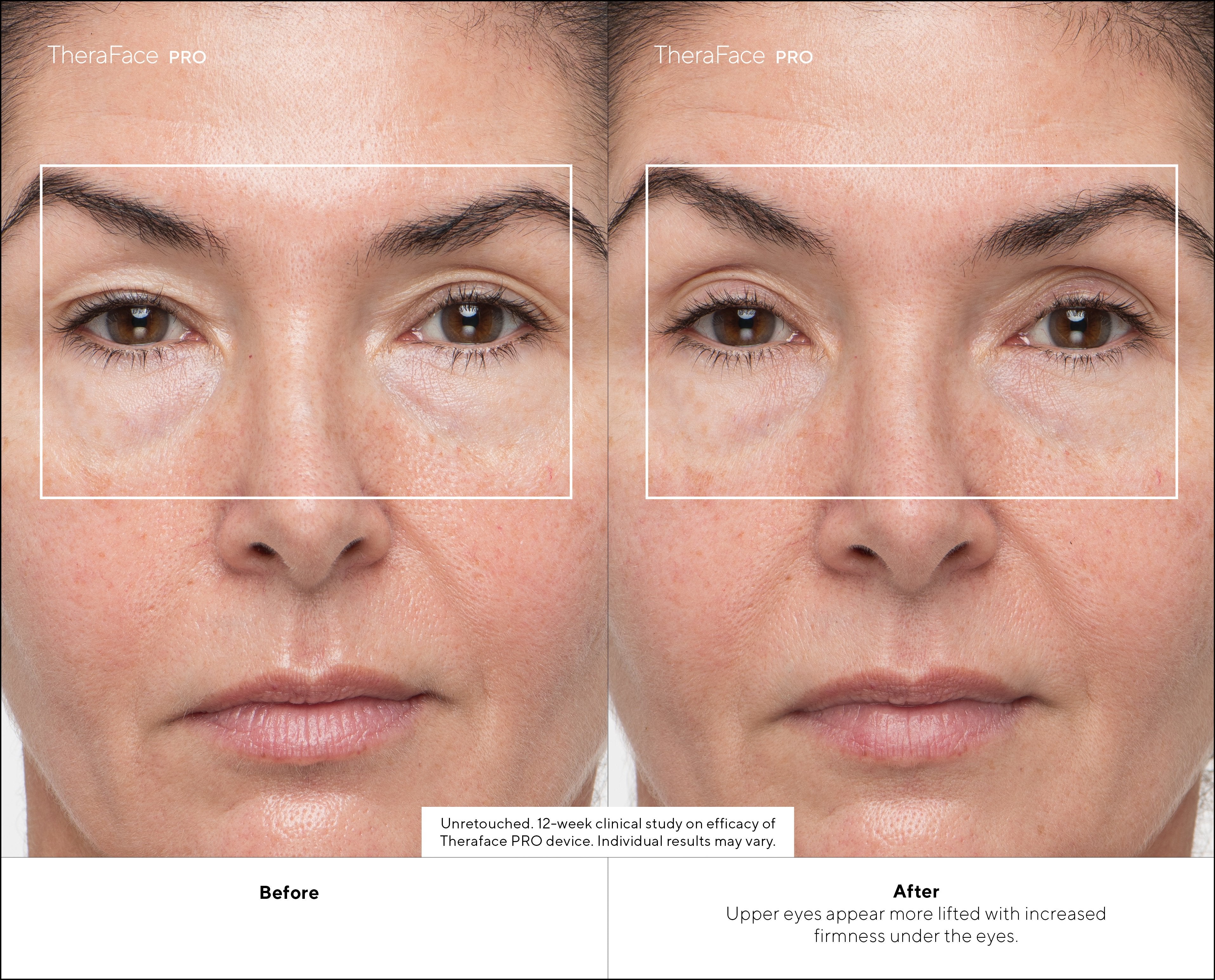 Masajeador Therabody Theraface Pro Cara Negro