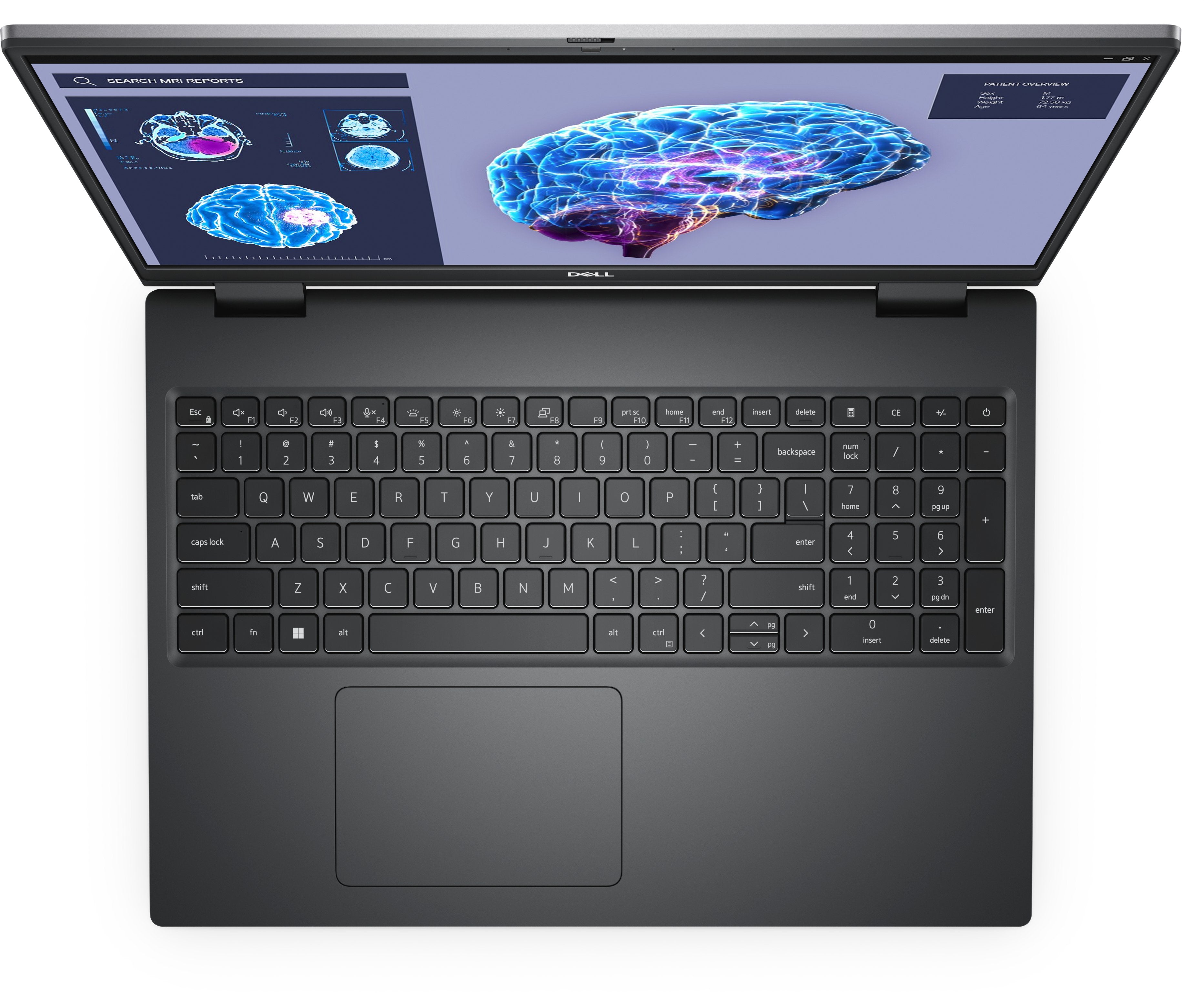 EAN 5397184810408 - DELL Precision 7680 Intel® Core™ i7 i7-13850HX Estación de trabajo móvil 40,6 cm (16") Full HD+ 32 GB DDR imagen 4