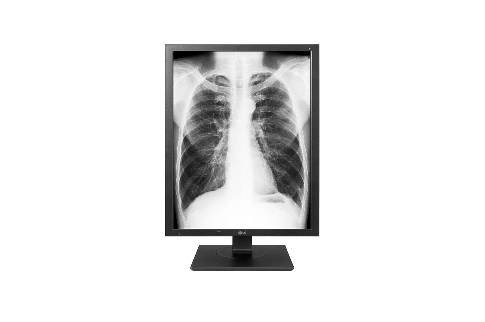 Monitor Lg Lcd Con Retroiluminación Led 21.3" - 3mp - Escala De Gris - 21.3"